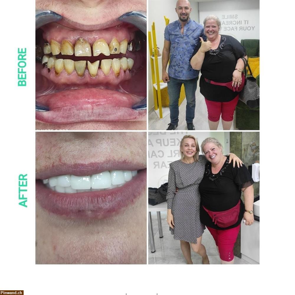 Bild 1: Zahnarzt Implantate in der Türkei
